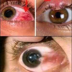 Did you know that your eyes are warning you if… See more