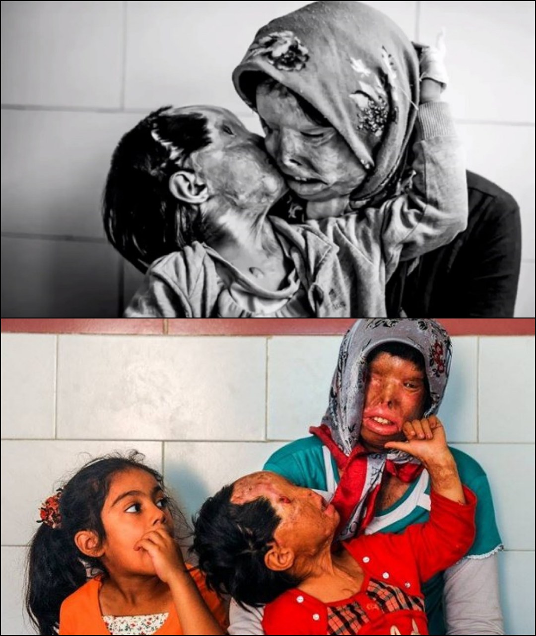 An Iranian Mother and Daughter’s Unbreakable Fight for Life and Healing After a Night That Changed Everything